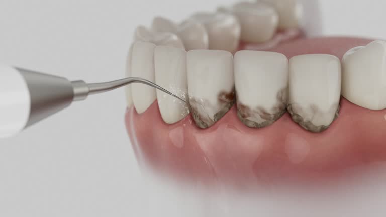 Reliable Dental Implants contractor in Leetonia, OH by Smile Center Dentistry